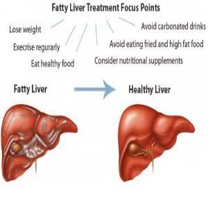fatty-liver